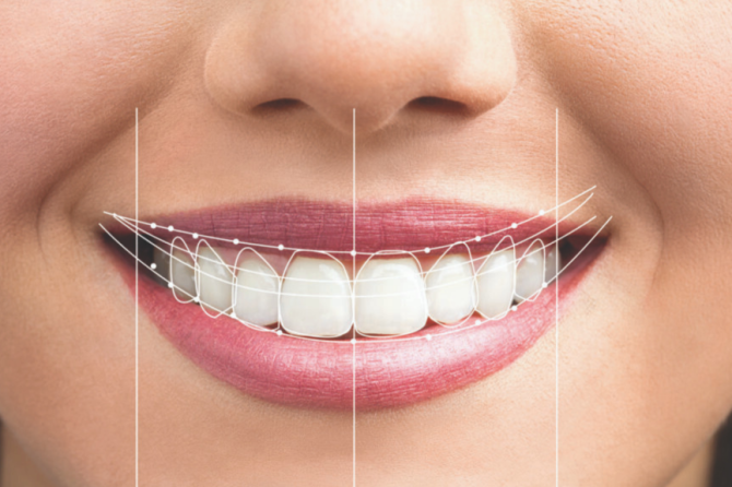 Estética dental: ¿qué es y cómo puede ayudarte a mejorar tu sonrisa?