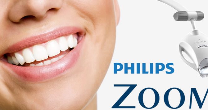 Blanqueamiento Dental Philips Zoom: La Mejor Opción para una Sonrisa Radiante