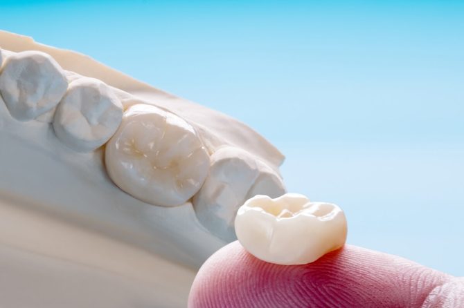 ¿Qué hacer si se te cae un empaste o se rompe una corona dental?
